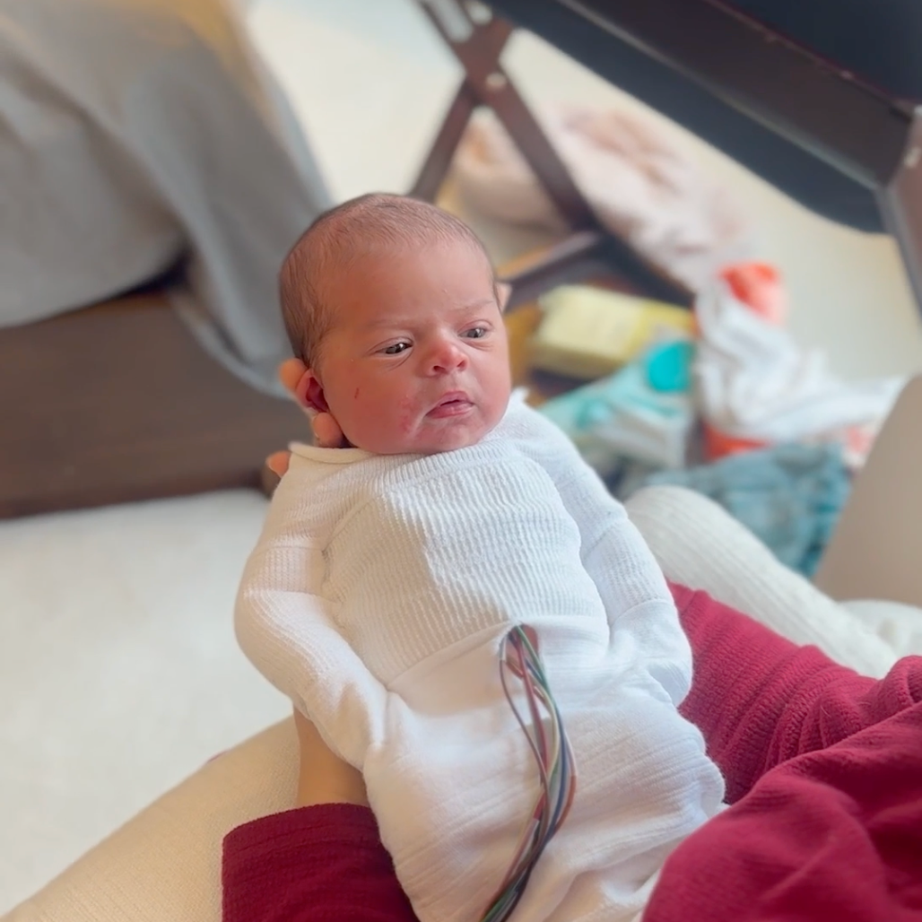 Infant wearing a Swaddelini sleep sack with an access opening for telemetry cables.